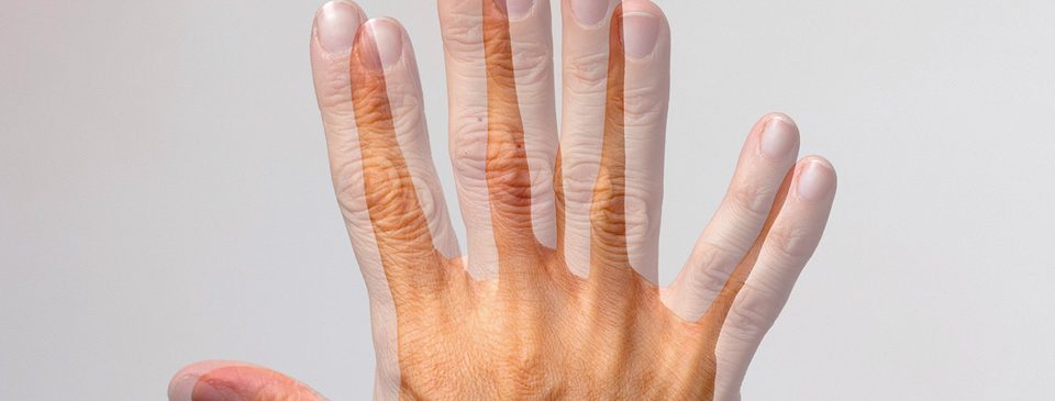 Immagine che simula la visione doppia (diplopia), sintomo che può essere influenzato dalla tensione cervicale e dai muscoli suboccipitali.